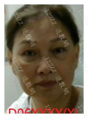 Case no.1728